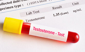 Low Testosterone Testing Fort Lauderdale